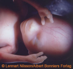 fetus16weeks2.jpg