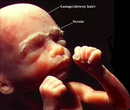 fetus24weeks.jpg